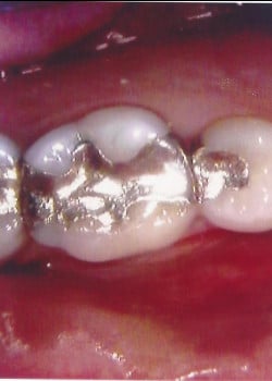 Before Image: Incrustations - front