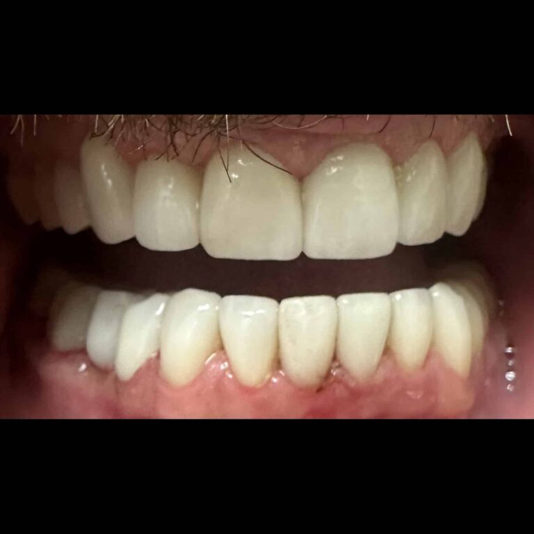 After Image: Métamorphose du Sourire - Devant